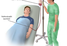 Dòng chảy tế bào máu và tiểu cầu trong nghiên cứu cơ chế aspirin ngăn chặn ung thư di căn