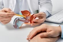 Bác sĩ ung bướu phân tích phác đồ điều trị ngăn ngừa di căn ung thư tuyến tiền liệt